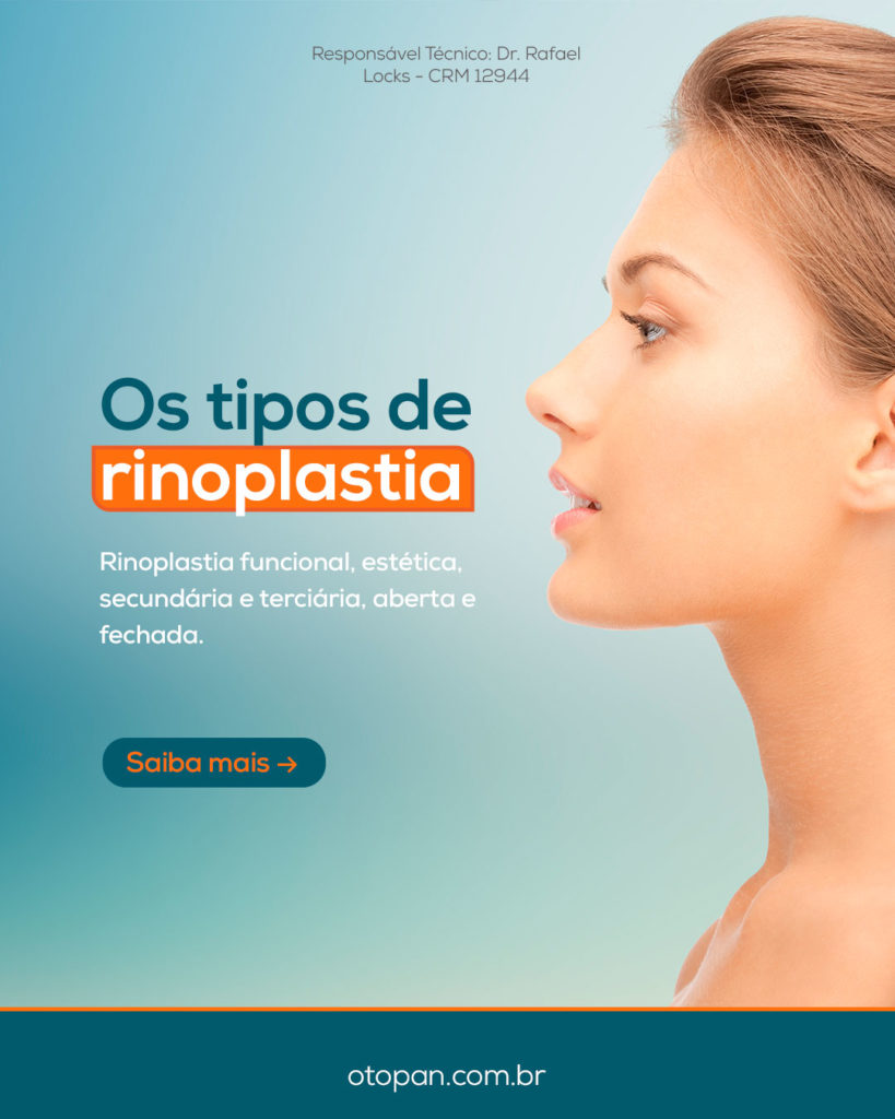 rinoplastia